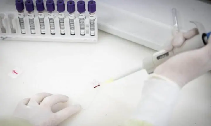 São Paulo investiga caso suspeito de Ebola e mantém vigilância em saúde no estado